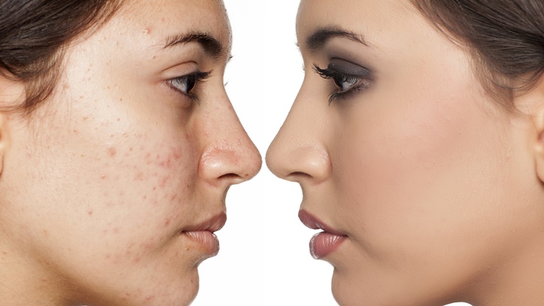 cuidar manchas y marcas en la piel